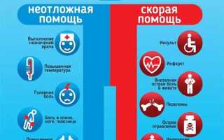 Чем отличается белая скорая от желтой