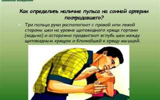 Как определить наличие пульса на сонной артерии пострадавшего