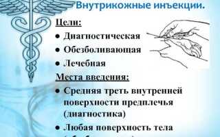Комплект для инжекции что это